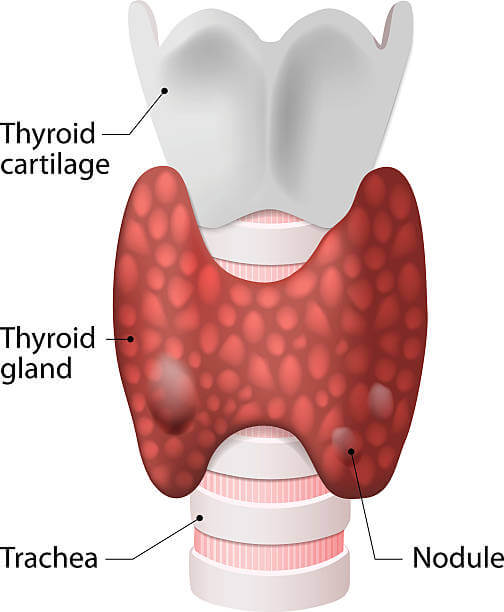 5 facts about thyroid hormone imbalance