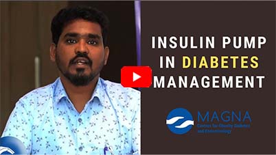 Insulin Pump in Diabetes Management