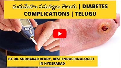 Diabetes complications | Telugu | Best Endocrinologist in India