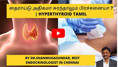 தைராய்டு அதிகமா சுரந்தாலும் பிரச்சனையா ? | Hyperthyroid Tamil