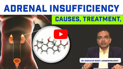 Adrenal insufficiency Causes