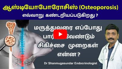 Osteoporosis causes symptoms