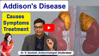 Addison Disease Causes Symptoms